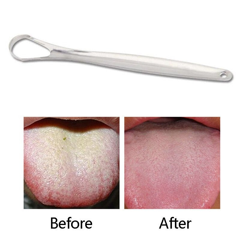 TONGUE SCRAPER
